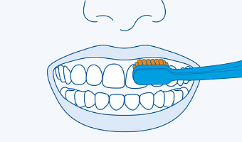 Самая эффективная техника чистки зубов
